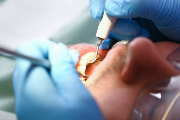 Best Cracked Tooth Emergency Dentist  in Cody, WY