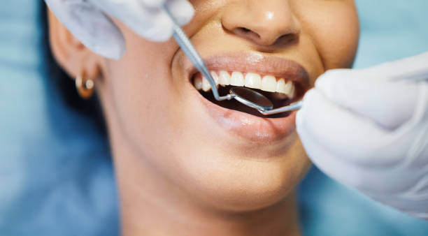 Best Root Canal Emergency Dentist  in Cody, WY