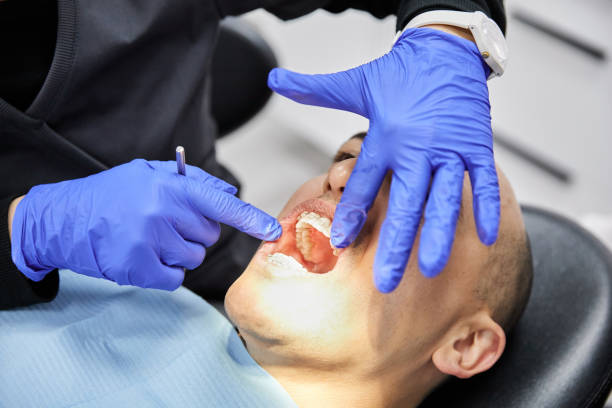 Best Dentist for Tooth Abscess  in Cody, WY